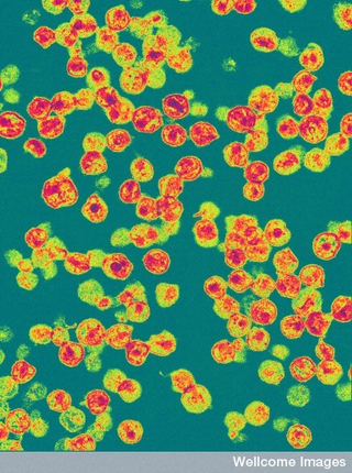 Illustration for article titled Will we ever have an HIV vaccine?